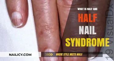 Understanding Half and Half Nail Syndrome: Causes, Symptoms, and Treatment