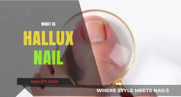 Understanding Hallux Nail: Causes, Symptoms, and Effective Treatment Options
