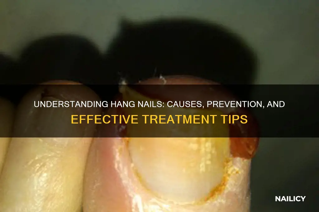 what is hamg nail
