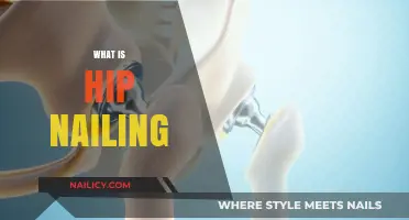 Understanding Hip Nailing: A Comprehensive Guide to Surgical Fracture Repair