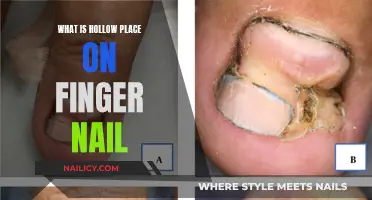 Unraveling the Mystery: What Causes a Hollow Place on Your Finger Nail?