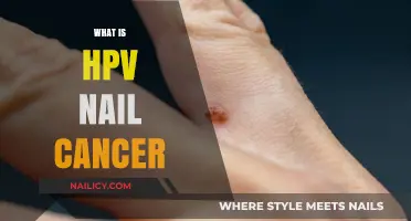 Understanding HPV-Related Nail Cancer: Causes, Symptoms, and Treatment Options