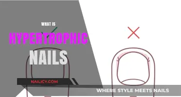 Understanding Hypertrophic Nails: Causes, Symptoms, and Effective Treatment Options