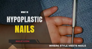 Understanding Hypoplastic Nails: Causes, Symptoms, and Treatment Options