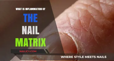 Understanding Nail Matrix Inflammation: Causes, Symptoms, and Treatment Options