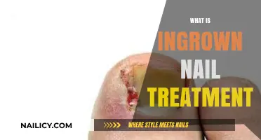 Effective Ingrown Nail Treatment: Relief, Prevention, and Home Care Tips