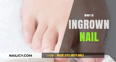 Understanding Ingrown Nails: Causes, Symptoms, and Effective Treatment Options