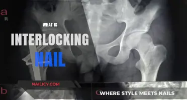 Understanding Interlocking Nails: Advanced Surgical Fixation for Fracture Healing