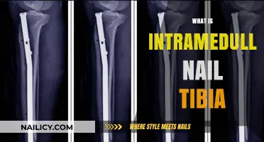 Understanding Intramedullary Nail Tibia: Procedure, Benefits, and Recovery Explained