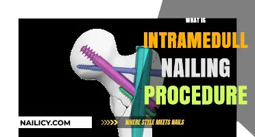 Understanding Intramedullary Nailing: A Comprehensive Guide to the Procedure