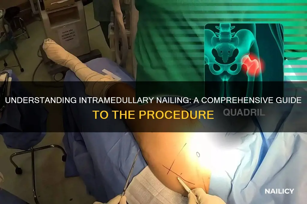 what is intramedullary nailing procedure