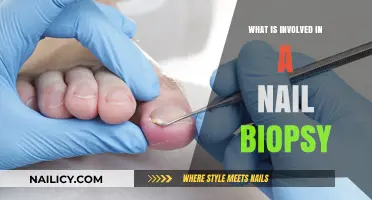 Understanding Nail Biopsy: Procedure, Preparation, and Post-Care Explained
