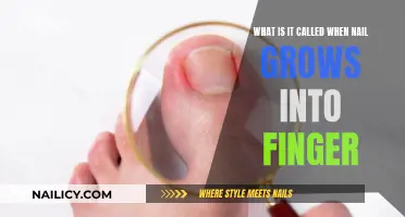 The Painful Problem of Ingrown Nails