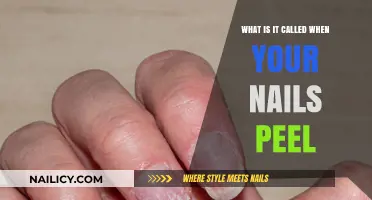 Why Do My Nails Peel? Understanding Onychoschizia and Nail Health