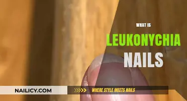 Understanding Leukonychia: Causes, Symptoms, and Treatment for White Nails