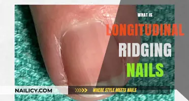 Understanding Longitudinal Ridging Nails: Causes, Symptoms, and Treatment Options