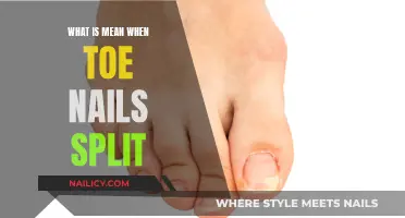 Understanding the Causes and Treatments for Split Toenails