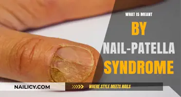 Understanding Nail-Patella Syndrome: Causes, Symptoms, and Treatment Explained