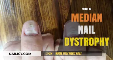 Understanding Median Nail Dystrophy: Causes, Symptoms, and Treatment Options