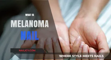 Understanding Melanoma Nail: Causes, Symptoms, and Early Detection Tips