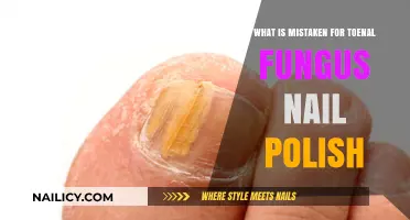 Common Toenail Conditions Mistaken for Fungus: Nail Polish and Beyond