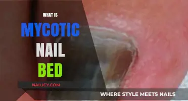Understanding Mycotic Nail Bed Infections: Causes, Symptoms, and Treatment Options