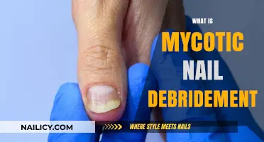 Understanding Mycotic Nail Debridement: Effective Treatment for Fungal Nail Infections