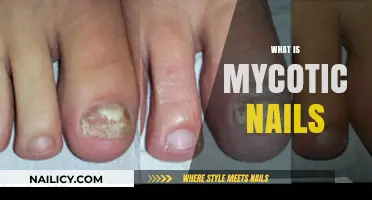 Understanding Mycotic Nails: Causes, Symptoms, and Effective Treatment Options