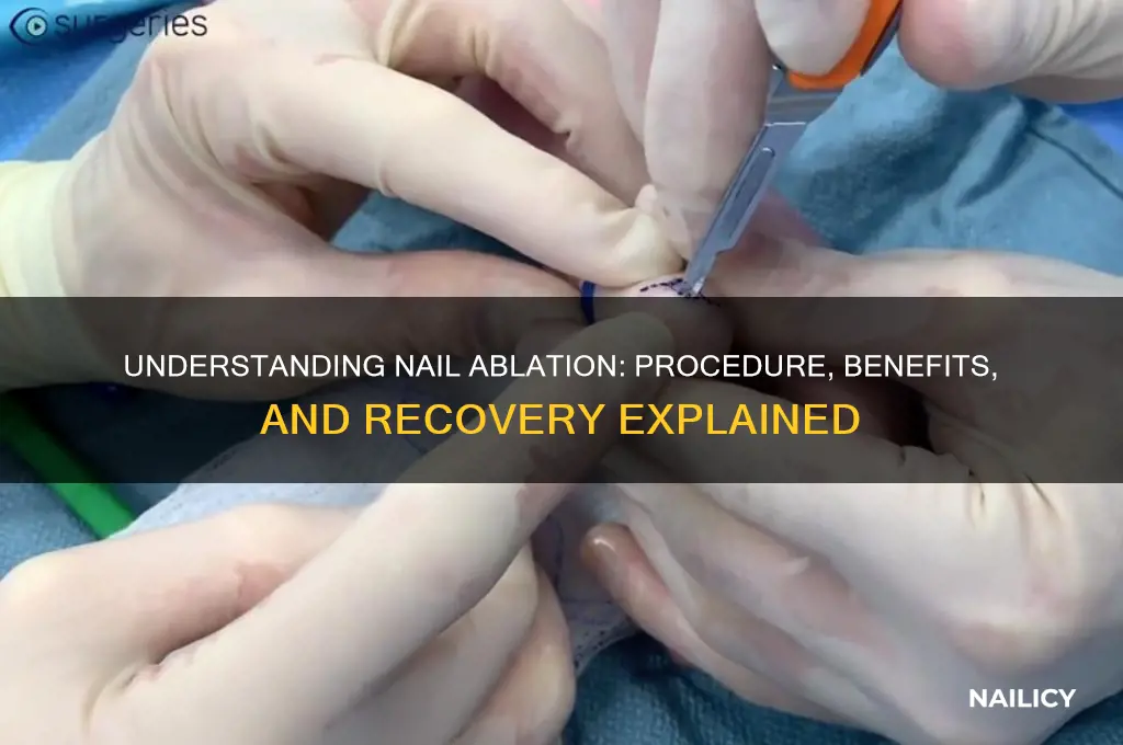 what is nail ablation