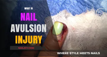 Understanding Nail Avulsion Injury: Causes, Symptoms, and Treatment Options