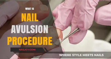 Understanding Nail Avulsion: A Comprehensive Guide to the Procedure