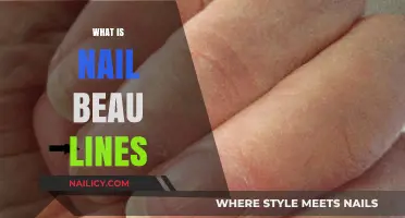 Understanding Nail Beau Lines: Causes, Symptoms, and Treatment Options