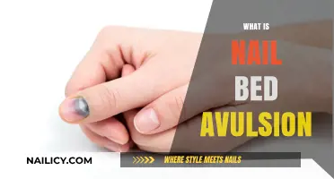 Understanding Nail Bed Avulsion: Causes, Symptoms, and Treatment Options