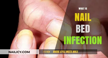 Understanding Nail Bed Infections: Causes, Symptoms, and Treatment Options