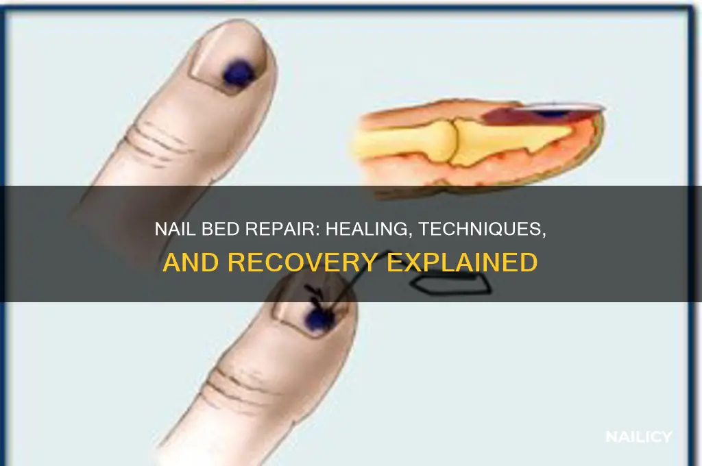 what is nail bed repair