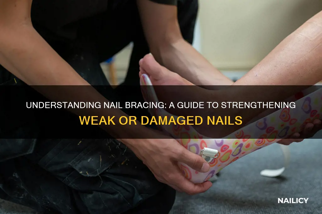 what is nail bracing
