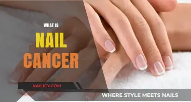 Understanding Nail Cancer: Symptoms, Causes, and Treatment Options Explained