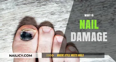 Understanding Nail Damage: Causes, Symptoms, and Effective Prevention Tips