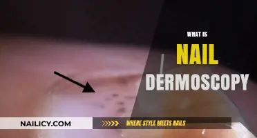 Understanding Nail Dermoscopy: A Comprehensive Guide to Nail Health