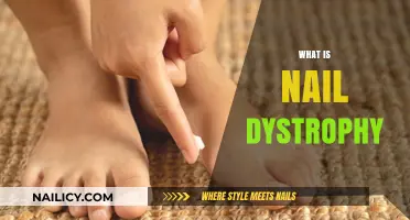Understanding Nail Dystrophy: Causes, Symptoms, and Treatment Options
