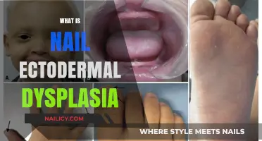 Understanding Nail Ectodermal Dysplasia: Causes, Symptoms, and Treatment Options