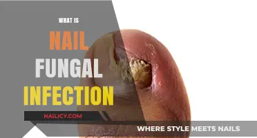 Understanding Nail Fungal Infections: Causes, Symptoms, and Treatment Options