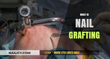 Understanding Nail Grafting: A Comprehensive Guide to Nail Restoration Techniques