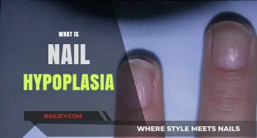Understanding Nail Hypoplasia: Causes, Symptoms, and Treatment Options Explained