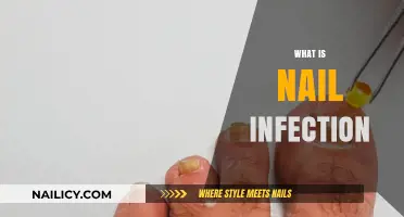 Understanding Nail Infections: Causes, Symptoms, and Effective Treatment Options