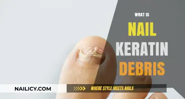 Understanding Nail Keratin Debris: Causes, Symptoms, and Effective Treatments