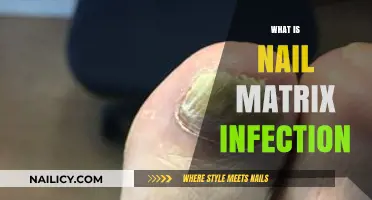 Understanding Nail Matrix Infections: Causes, Symptoms, and Treatment Options