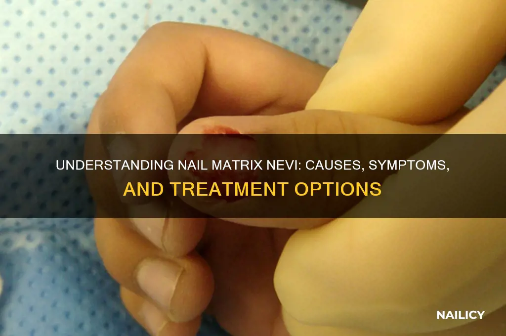 what is nail matrix nevi