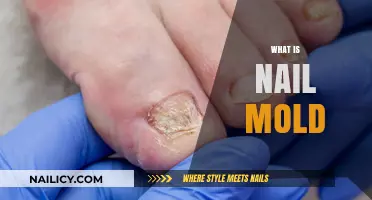 Understanding Nail Mold: Causes, Symptoms, and Effective Treatment Options