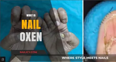 Understanding Nail Oxen: A Comprehensive Guide to This Unique Phenomenon